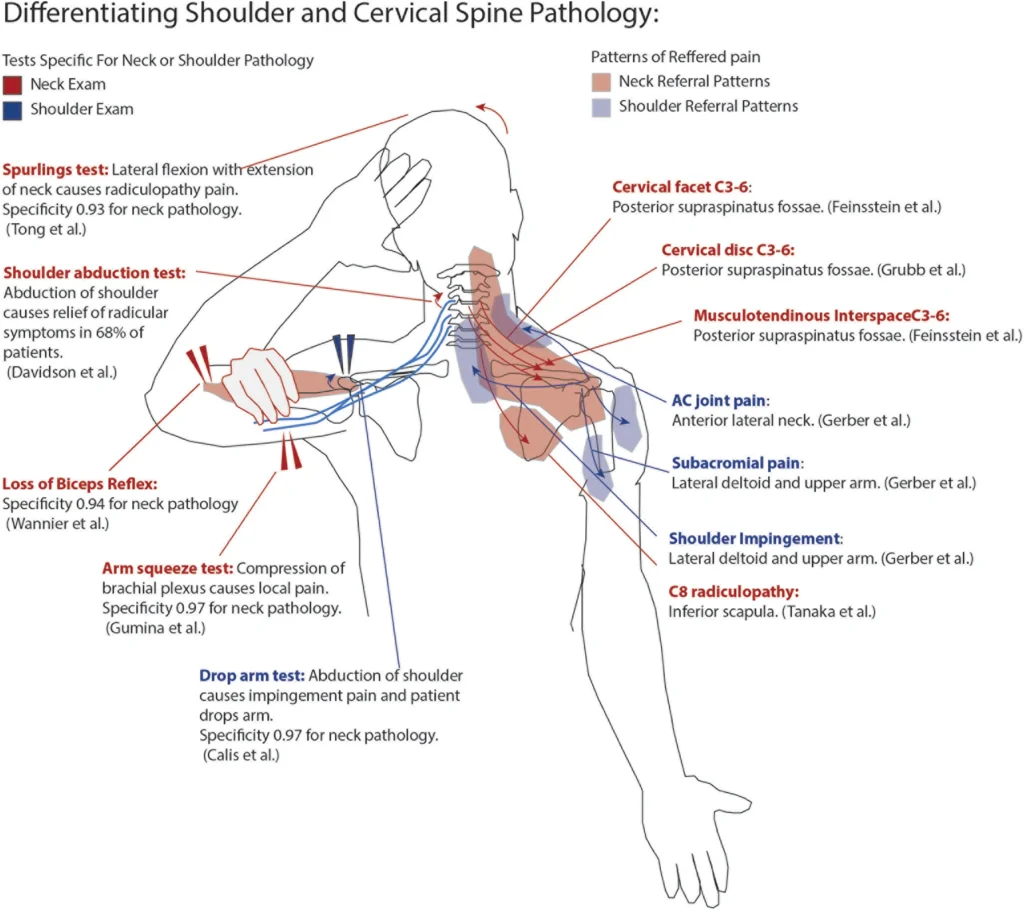 목 통증과 어깨 통증의 과학 - 왜 구분이 어려운가?